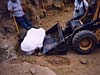 Leg bone removal